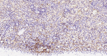 Human STAT1 Ready-To-Use IHC Kit