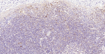 Human STAT1 Ready-To-Use IHC Kit