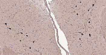 Mouse Tyrosine Hydroxylase Ready-To-Use IHC Kit