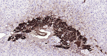 Human Tyrosine Hydroxylase Ready-To-Use IHC Kit