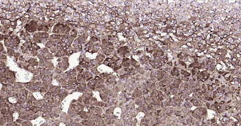 Tyrosine Hydroxylase Ready-To-Use IHC Kit