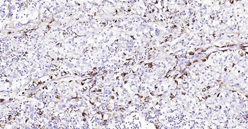 Human CD68 Ready-To-Use IHC Kit