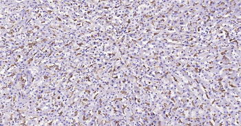 Human CD68 Ready-To-Use IHC Kit