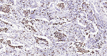 Human CD68 Ready-To-Use IHC Kit