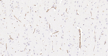Human HLA E Ready-To-Use IHC Kit