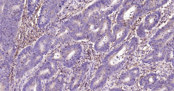 Human HLA E Ready-To-Use IHC Kit