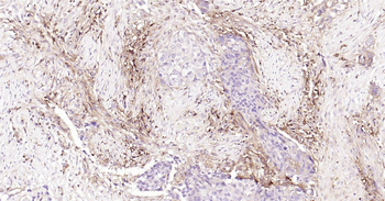 Human HLA E Ready-To-Use IHC Kit