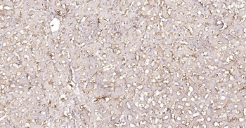 Human HLA E Ready-To-Use IHC Kit