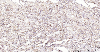 Human HLA E Ready-To-Use IHC Kit