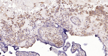 Human HLA E Ready-To-Use IHC Kit