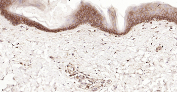 Human HLA E Ready-To-Use IHC Kit
