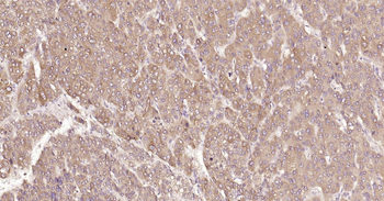 Human CRIM1 Ready-To-Use IHC Kit