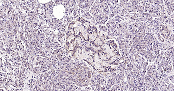Human CRIM1 Ready-To-Use IHC Kit