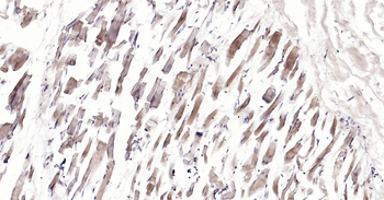 Human CRIM1 Ready-To-Use IHC Kit
