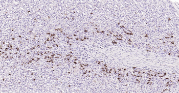 CHGA Ready-To-Use IHC Kit