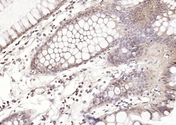 RBX1 Rabbit Polyclonal Antibody