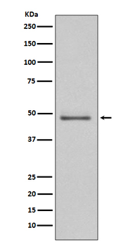 MEK5 Recombinant Rabbit Monoclonal Antibody