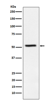 WARS1 Recombinant Rabbit Monoclonal Antibody