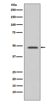 VASP Recombinant Rabbit Monoclonal Antibody
