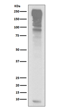 Ubiquitin Recombinant Rabbit Monoclonal Antibody