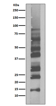 K63-linkage specific ubiquitin Recombinant Rabbit Monoclonal Antibody