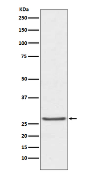 TIMP-1 Recombinant Rabbit Monoclonal Antibody