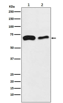 FATP4 Recombinant Rabbit Monoclonal Antibody