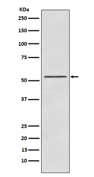 RPS6KB2 Recombinant Rabbit Monoclonal Antibody