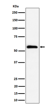 PNKP Recombinant Rabbit Monoclonal Antibody
