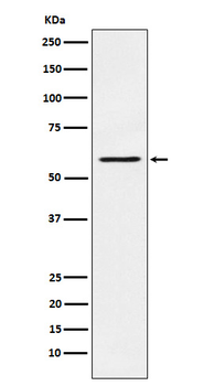 PAK1 Recombinant Rabbit Monoclonal Antibody