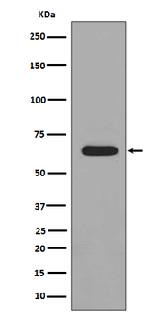 Phospho-PAK1/2/3 (Ser144/Ser141/Ser154) Recombinant Rabbit Monoclonal Antibody