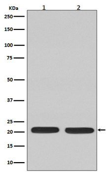 NRAS Recombinant Rabbit Monoclonal Antibody