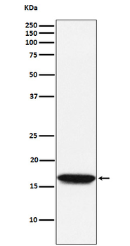 NME1/NM23A Recombinant Rabbit Monoclonal Antibody
