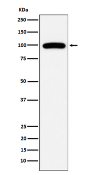 CD10 Recombinant Rabbit Monoclonal Antibody