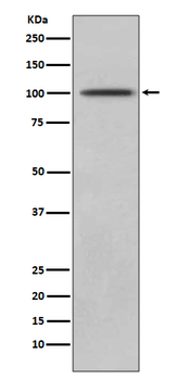 CD10 Recombinant Rabbit Monoclonal Antibody