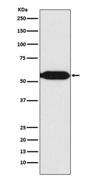 MEF2C Recombinant Rabbit Monoclonal Antibody