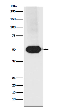 MEF2A/MEF2C Recombinant Rabbit Monoclonal Antibody
