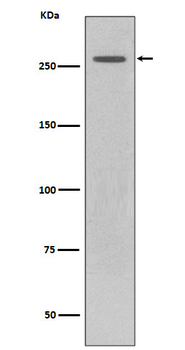 LRRK2 Recombinant Rabbit Monoclonal Antibody