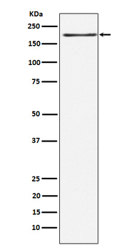 LRP6 Recombinant Rabbit Monoclonal Antibody