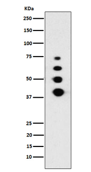 Lamin A/C Recombinant Rabbit Monoclonal Antibody
