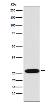 Lin28 Recombinant Rabbit Monoclonal Antibody
