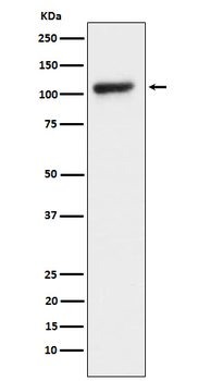 KDM1/LSD1 Recombinant Rabbit Monoclonal Antibody