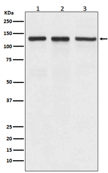 Integrin alpha V Recombinant Rabbit Monoclonal Antibody