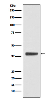 Islet-1 Recombinant Rabbit Monoclonal Antibody