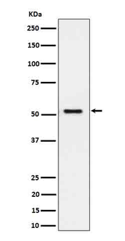 SEC62 Recombinant Rabbit Monoclonal Antibody