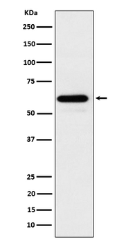 HRPT2 Recombinant Rabbit Monoclonal Antibody