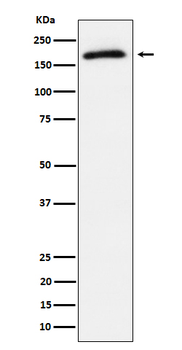 Phospho-TBC1D4 (Thr642) Recombinant Rabbit Monoclonal Antibody