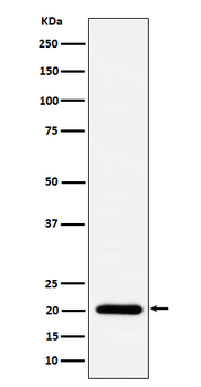 TIMM22 Recombinant Rabbit Monoclonal Antibody