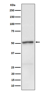 Phospho-RIPK3 (Ser232) Recombinant Rabbit Monoclonal Antibody