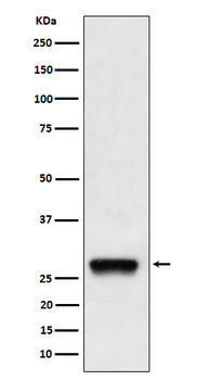 PDGF-B Recombinant Rabbit Monoclonal Antibody